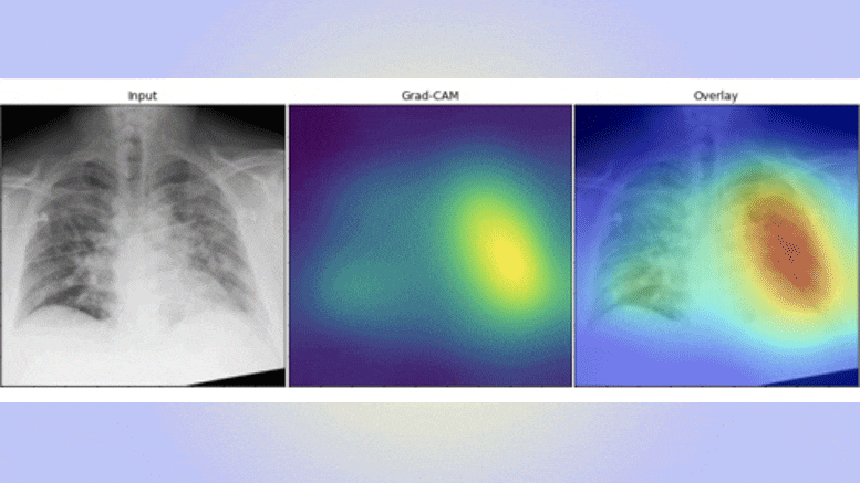 KI erkennt Covid-19 auf Bruströntgenstrahlen genauer und zehnmal schneller als spezialisierte Radiologen