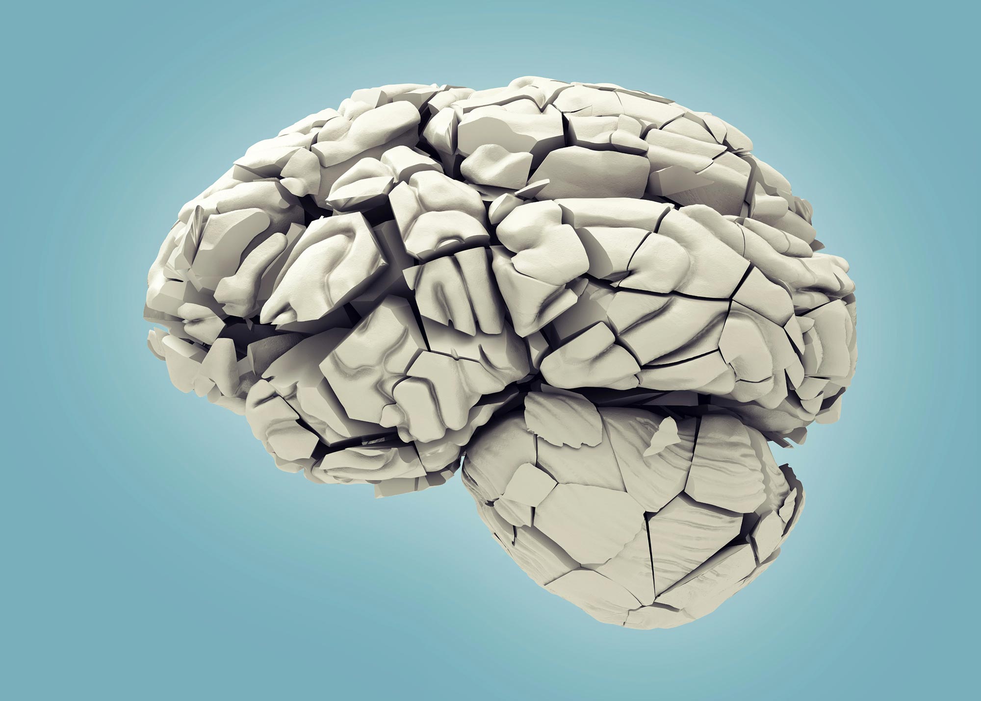 Astrozytenbruch: Ein bahnbrechender Biomarker für die Erkennung der frühen Alzheimer