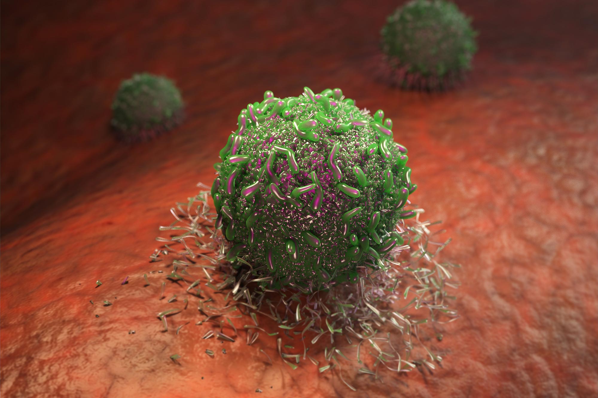 Erste Behandlung für eine seltene Form von Krebs entdeckt