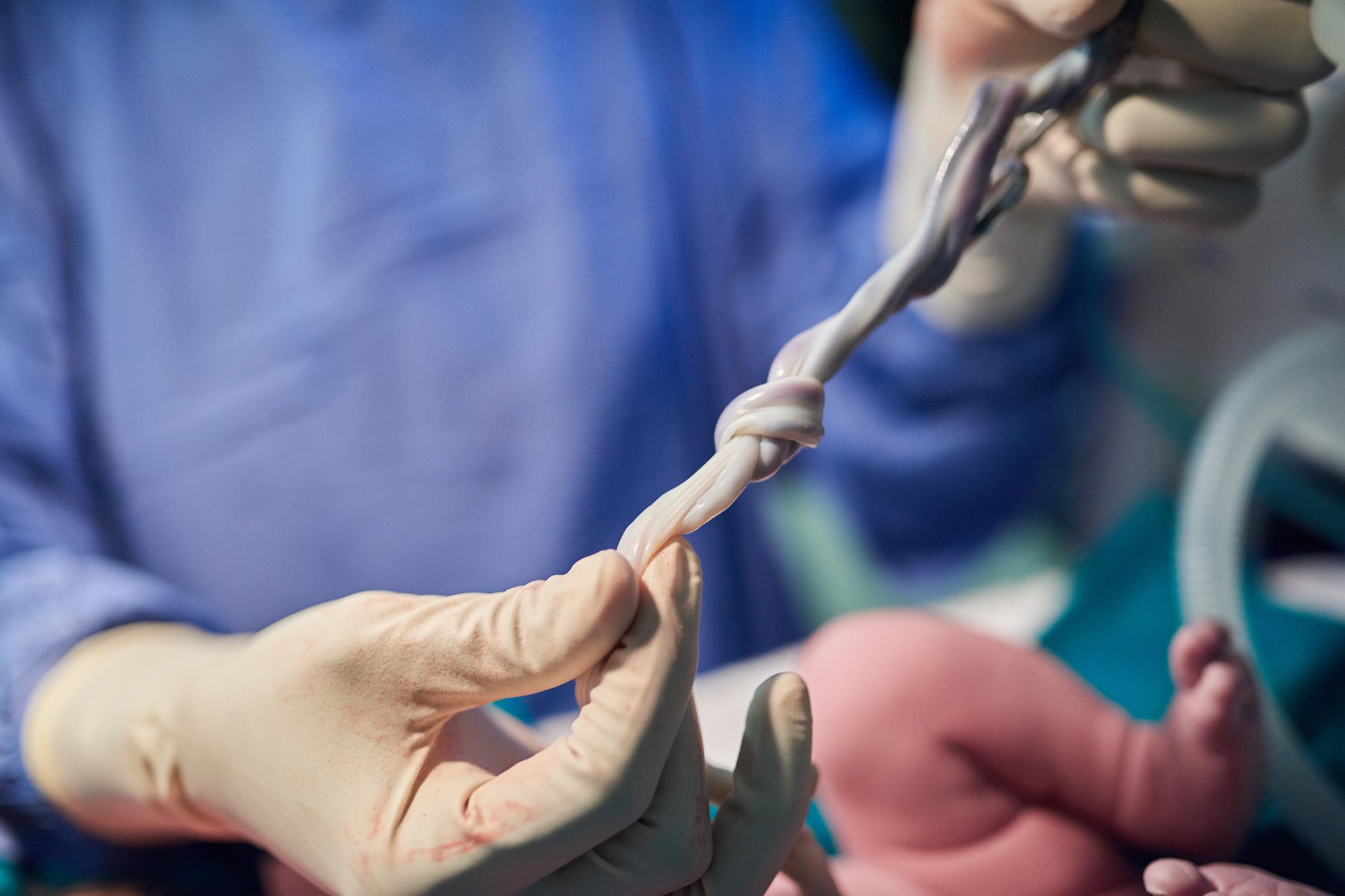 Wissenschaftler haben gerade etwas Besorgniserregendes im Nabelschnurblut entdeckt