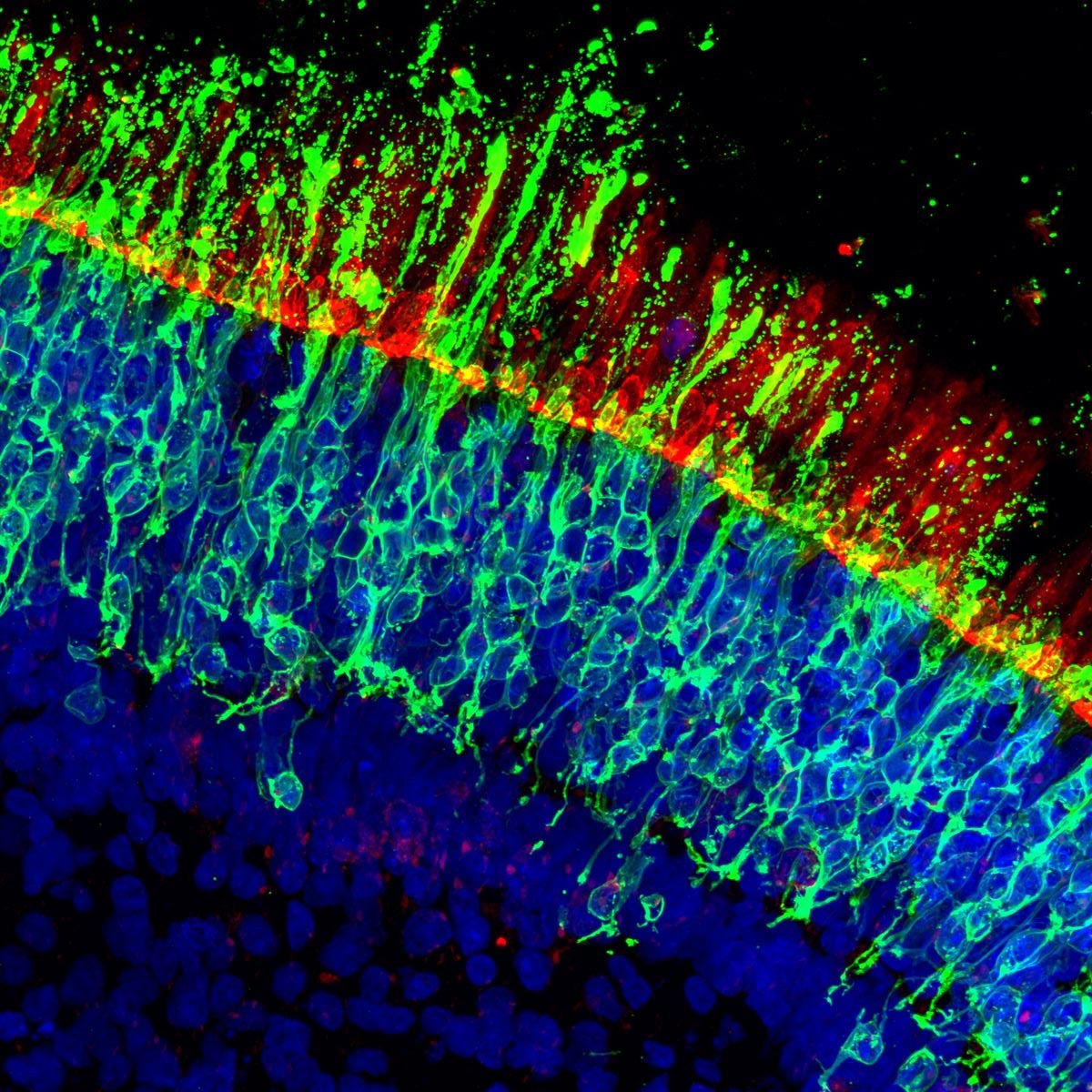Wissenschaftler entdecken, wie man Sehverlust stoppen kann, bevor er beginnt