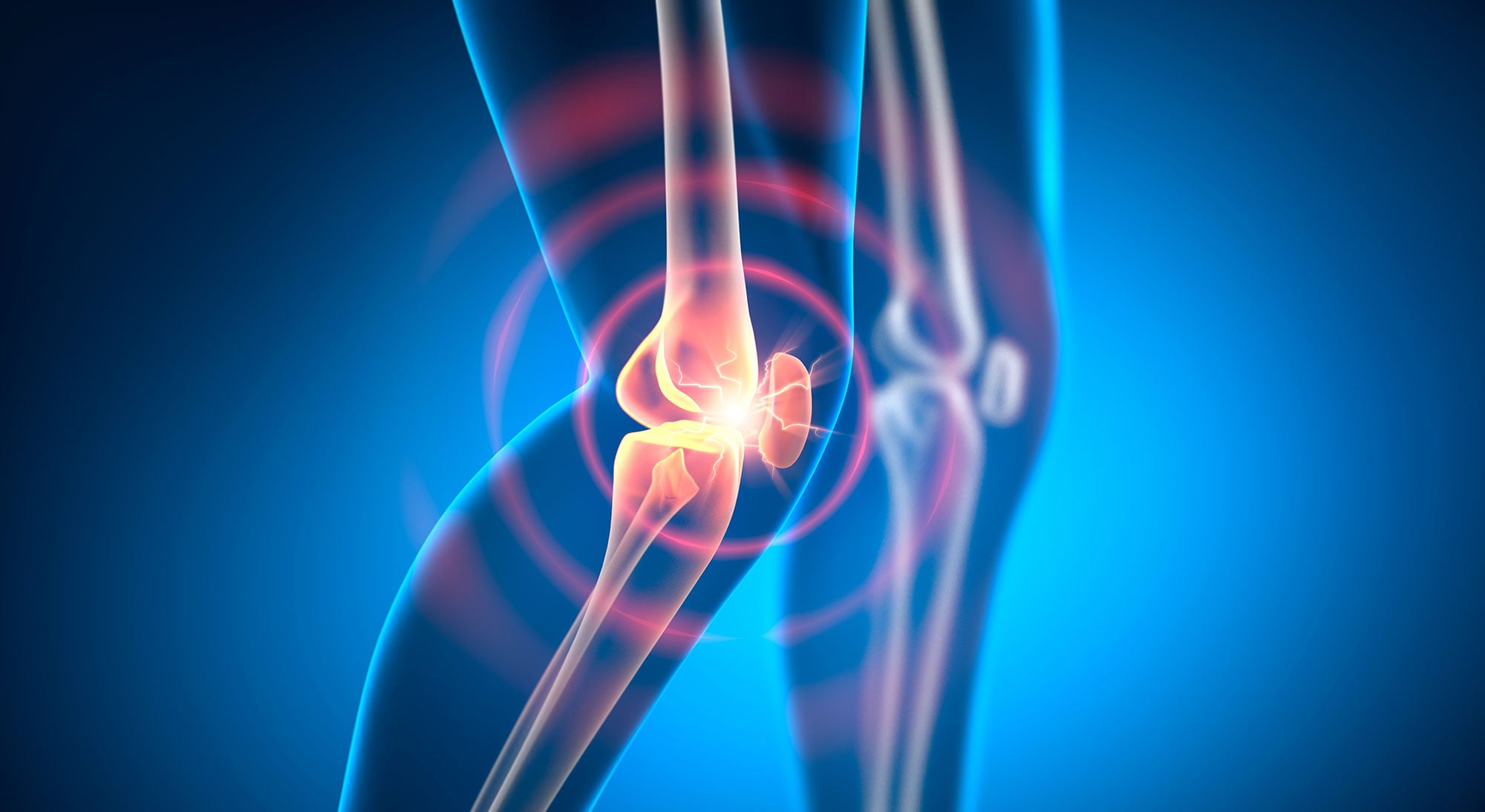 Jenseits der Entzündung: Wissenschaftler entdecken neue Ursache für anhaltende rheumatoide Arthritis