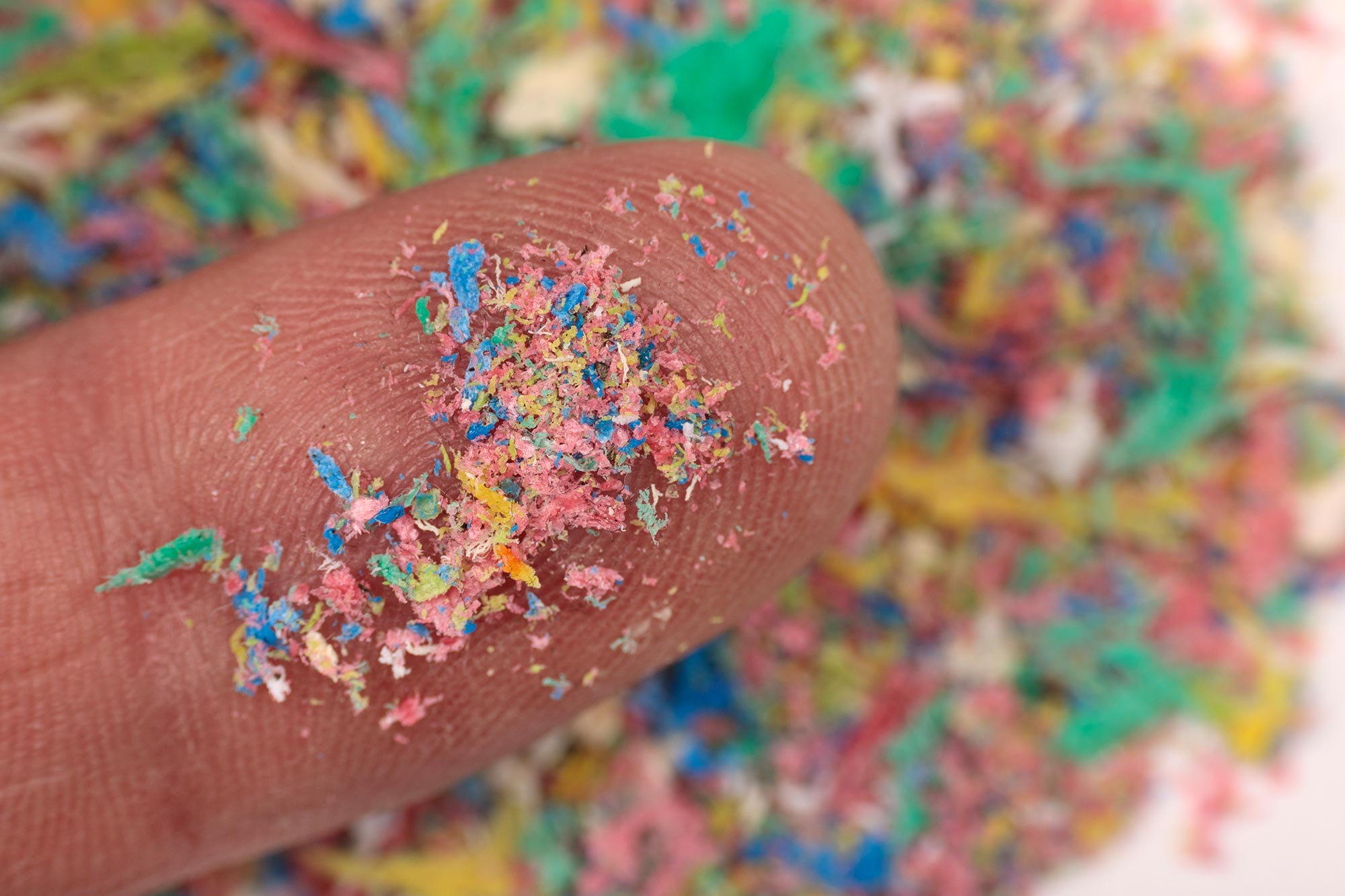 90 % der Prostatakrebstumoren enthielten Mikroplastik