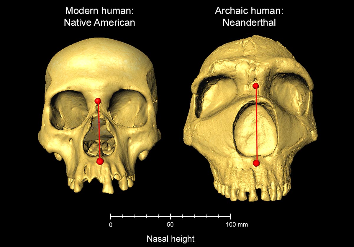 Kalte Klimaanpassung: Neandertaler Genetik formen unsere Gesichtszüge