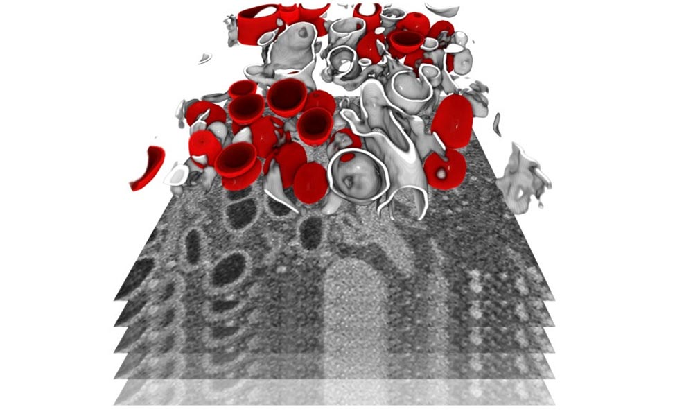 Replikationszyklus von SARS-COV-2 in 3D-„Wir können erwarten, dass der Coronavirus saisonal wird.“