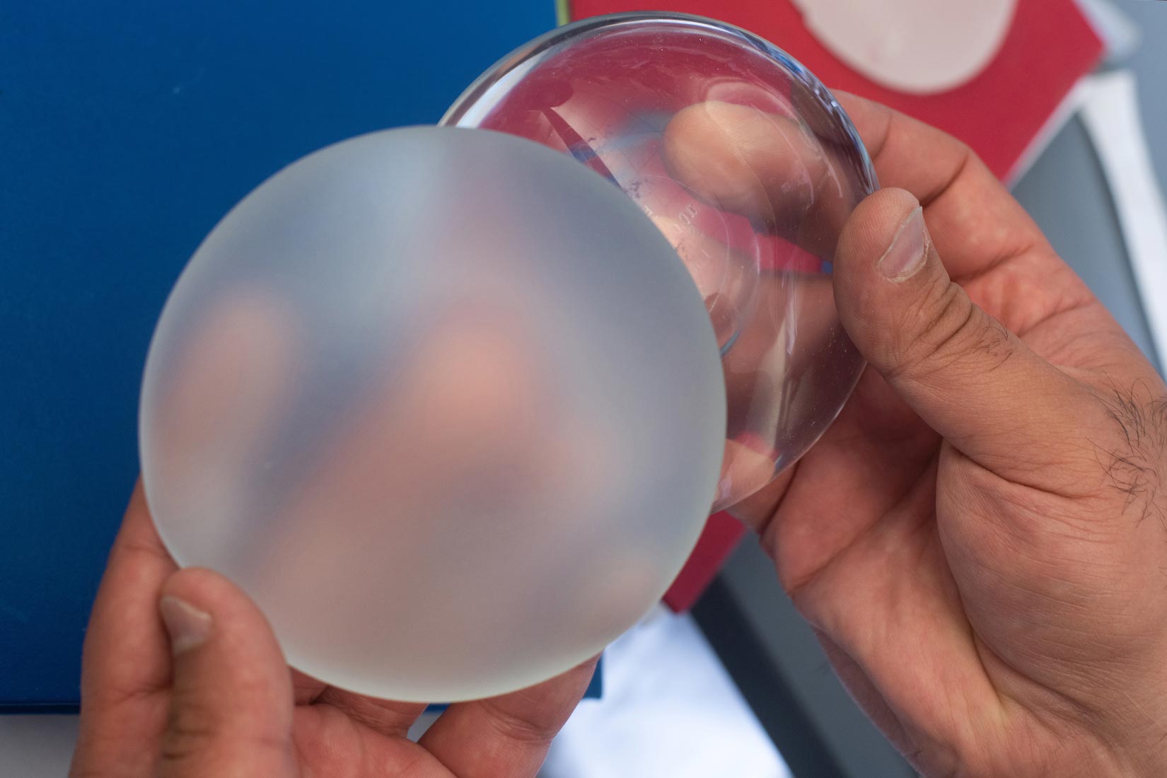 Zu sichereren Brustimplantaten: Wie Implantatflächen die Immunantwort beeinflussen