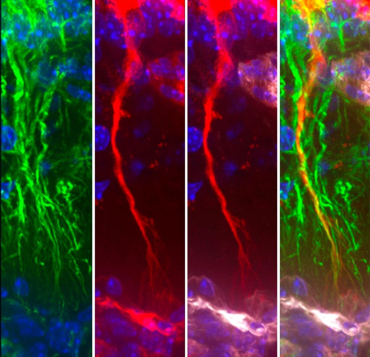 Wissenschaftler entdecken versteckte Gehirnzellen, die giftiges Alzheimer-Protein entfernen