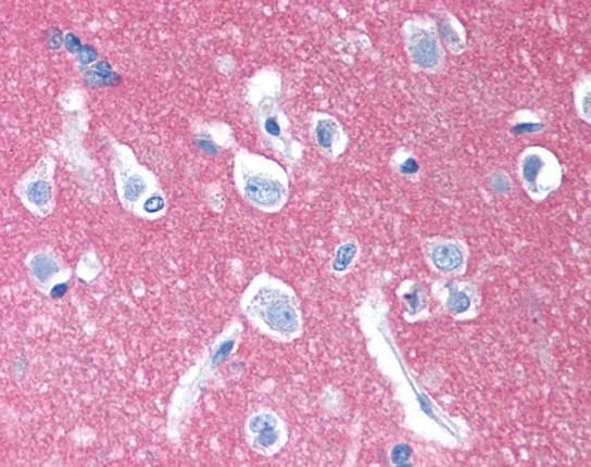 cd47-up-close